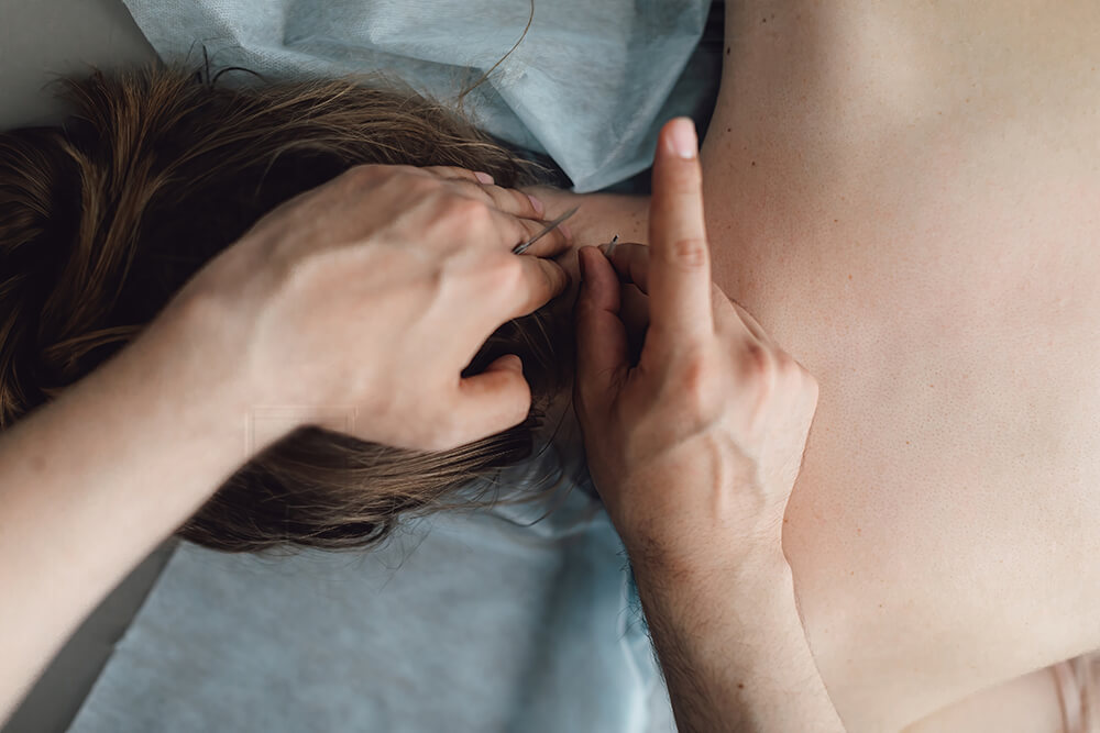 the pros and cons of dry needling dry needling